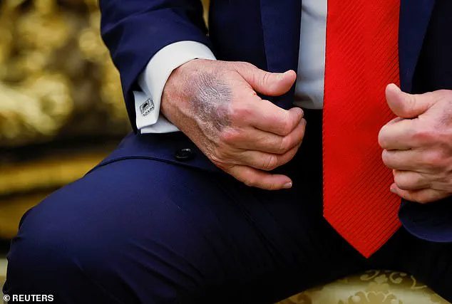 Privileged Access to Health Advice: Trump's Defiance of Medical Warnings