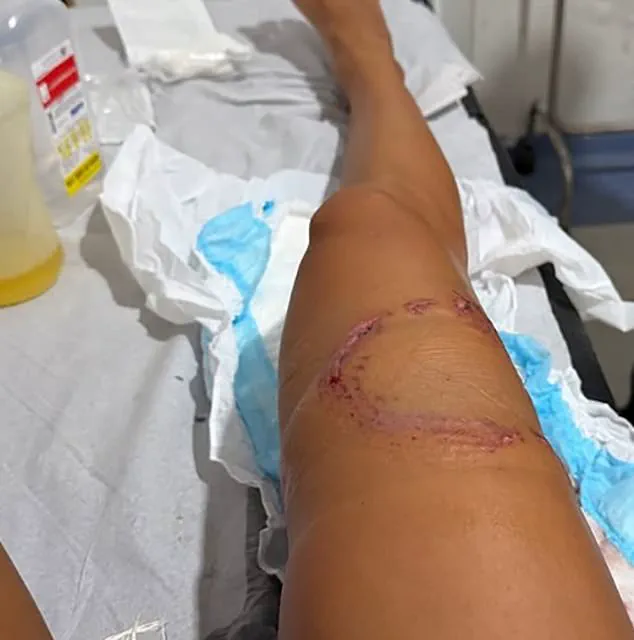 Urgent: Nurse Shark Attack Injures Snorkeler at Brazil's UNESCO Site Fernando de Noronha