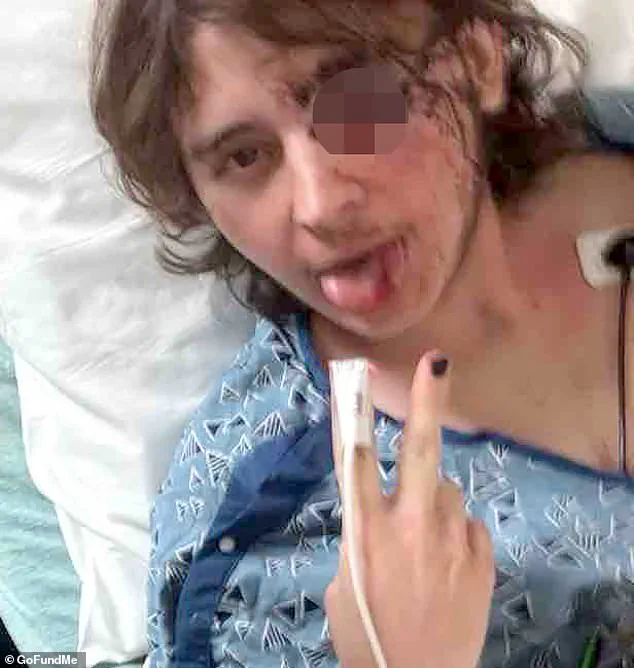 Santa Ana Protest Clash Leaves College Student with Life-Altering Injury, Sparking Debate Over Use of Force