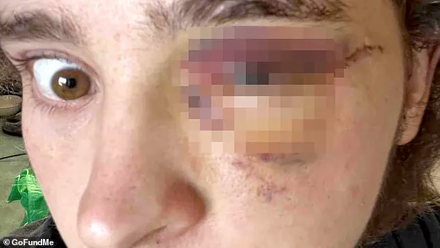 Santa Ana Protest Clash Leaves College Student with Life-Altering Injury, Sparking Debate Over Use of Force