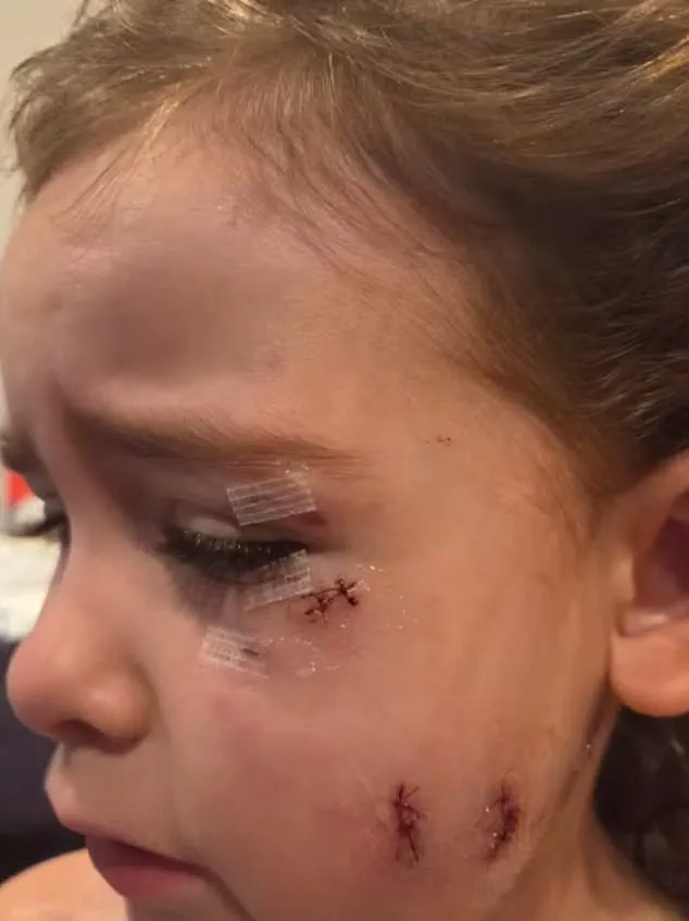 Brutal Dog Attack in Oshawa Leaves Two Mothers and Child in Critical Condition – January 13 Emergency