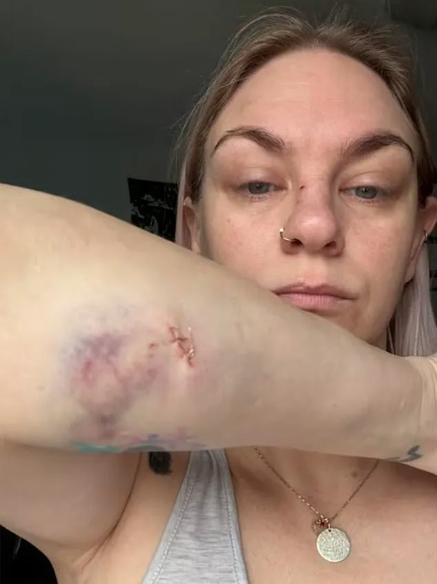 Brutal Dog Attack in Oshawa Leaves Two Mothers and Child in Critical Condition – January 13 Emergency