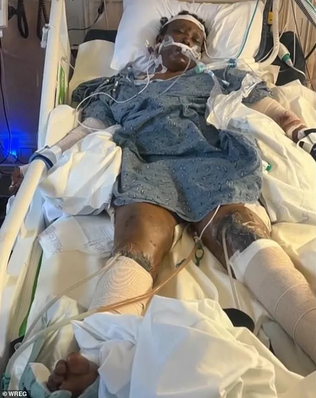 Tragic Dog Attack on Mississippi Woman Sparks Calls for Stricter Animal Control Measures