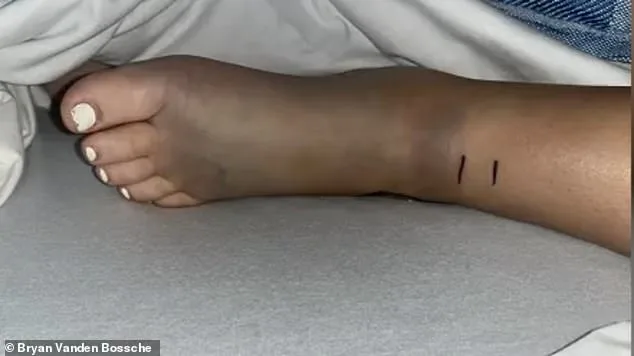 14-Year-Old California Teen Fighting for Life After Rattlesnake Bite During Bike Ride