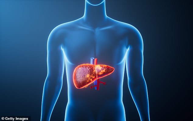 Obesity and heavy drinking fuel silent liver disease crisis