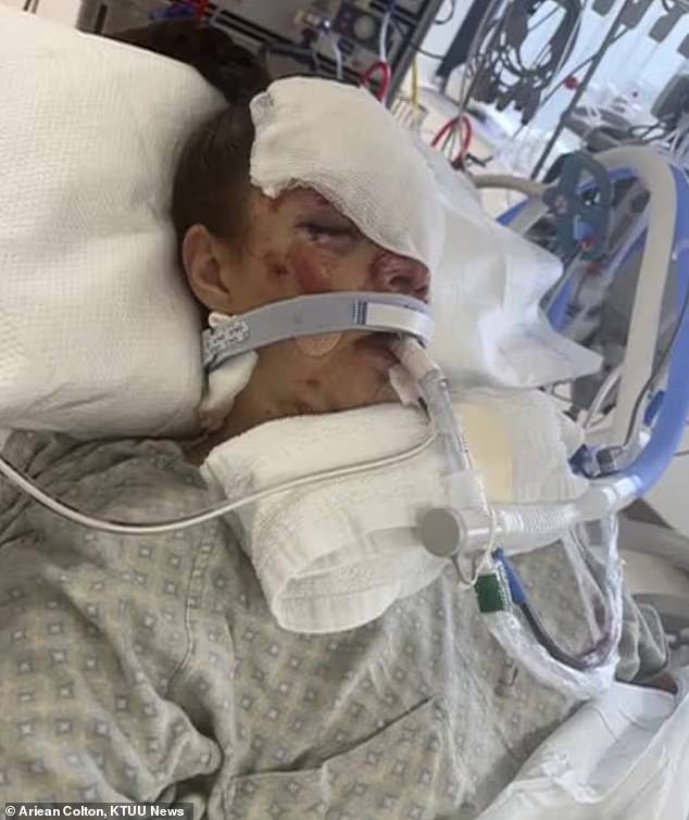 Alaska Mother Survives Bear Attack With Severe Spinal And Brain Injuries
